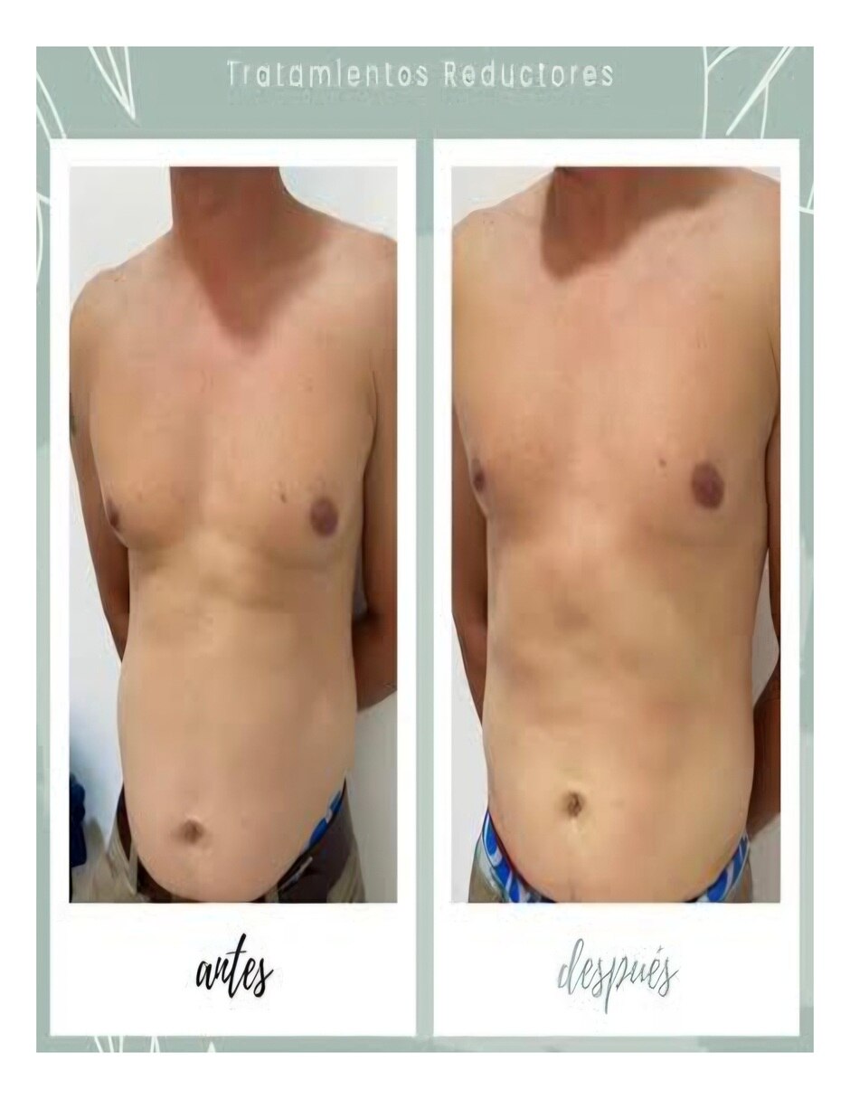 Kit Reductor Abdominal con Multivitaminico sabor No saborizado de