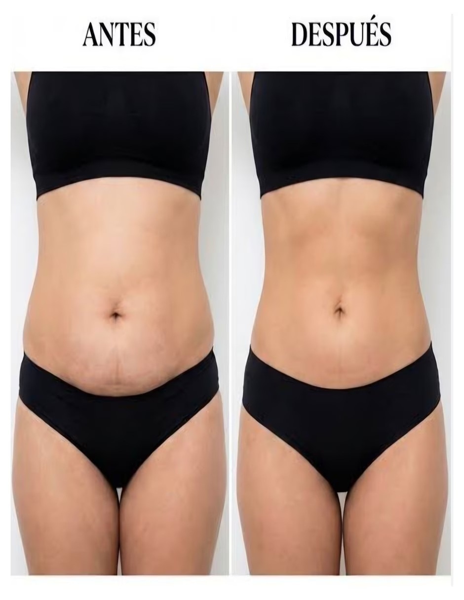 Kit Reductor Abdominal con Multivitaminico sabor No saborizado de 5